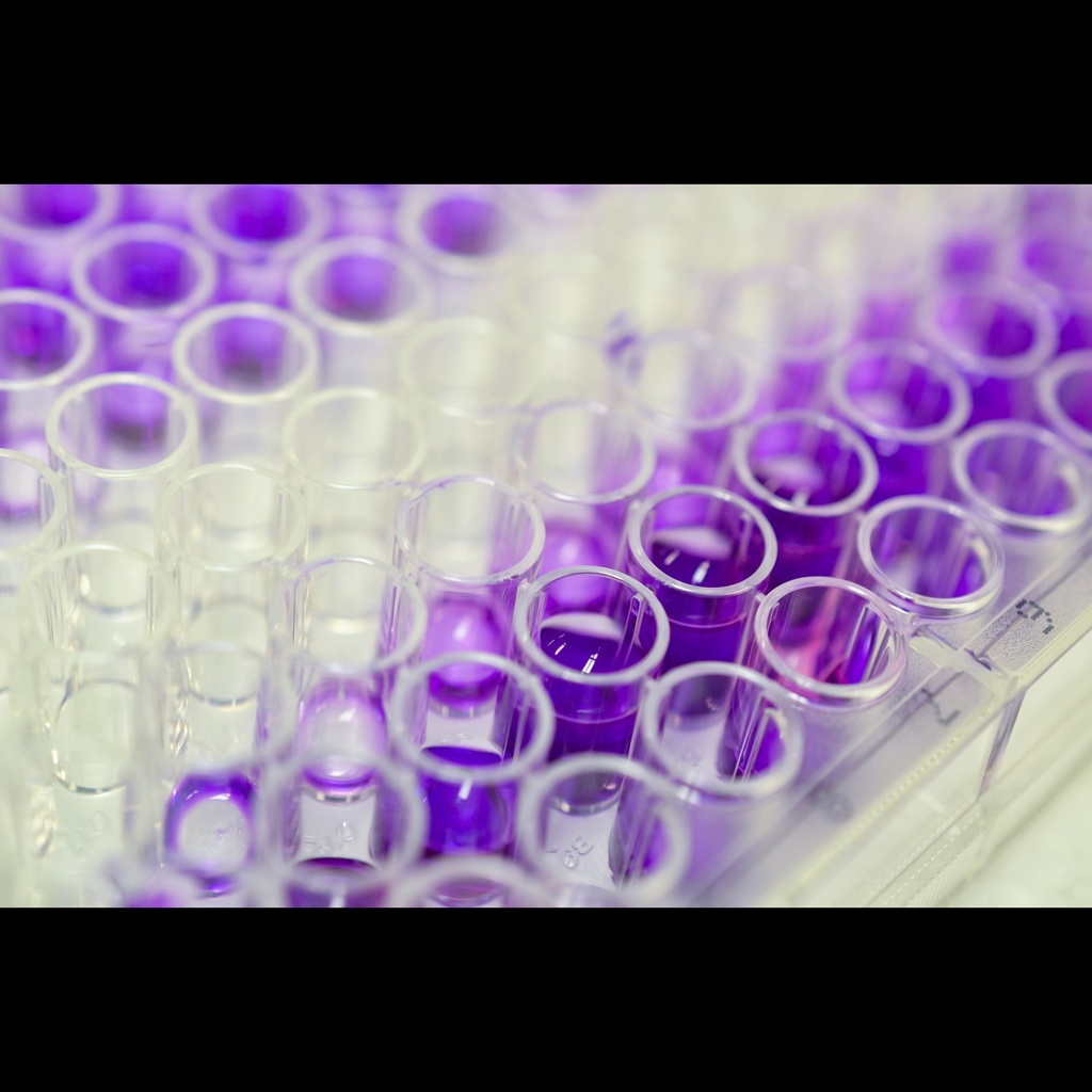 Fish transforming growth factor, beta 1  TGFB1  ELISA kitsize:96T